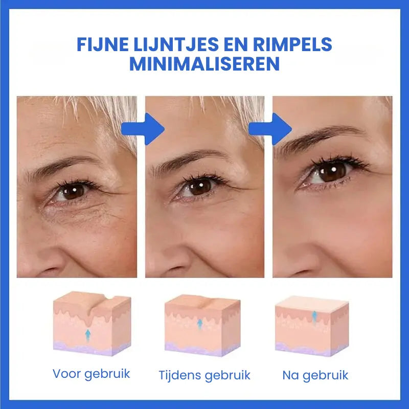 SkinLift™ | Botox Ansigt Serum