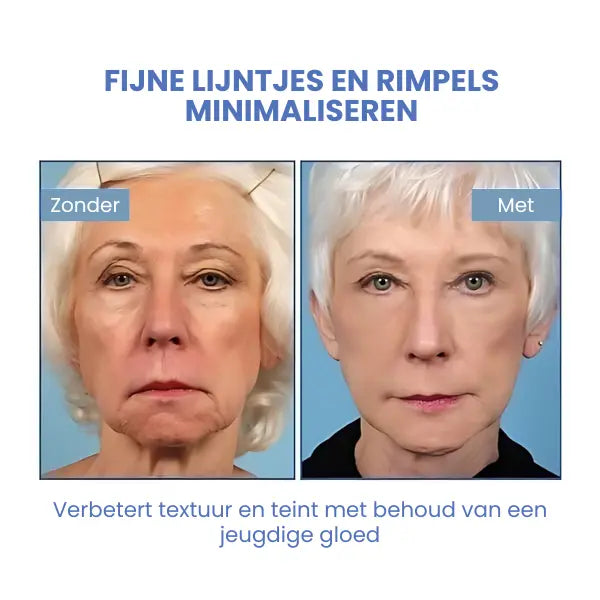 SkinLift™ | Botox Ansigt Serum