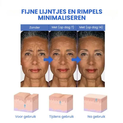 SkinLift™ | Botox Ansigt Serum