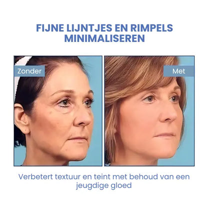 SkinLift™ | Botox Ansigt Serum